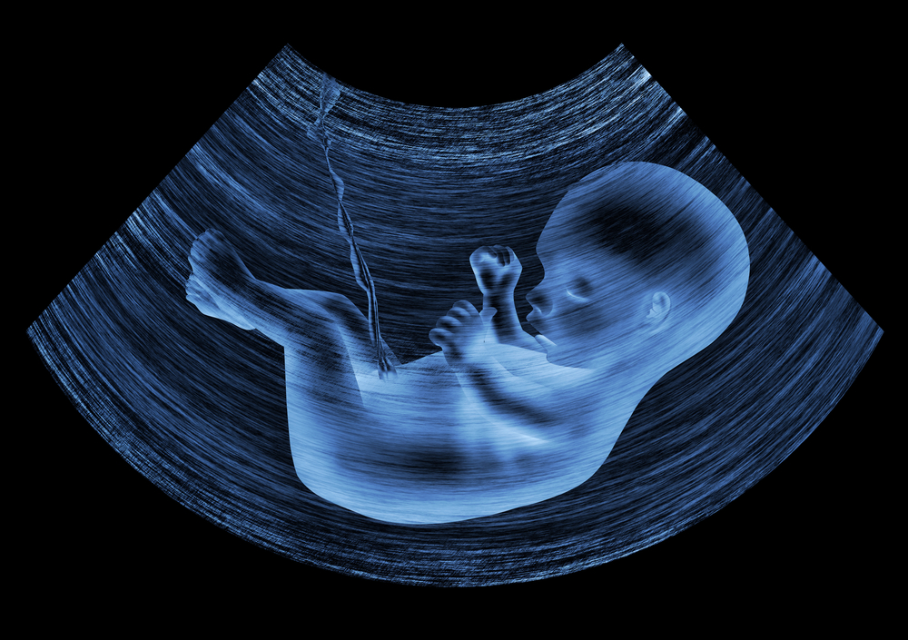 Don t Kid Yourself We re All Subsidizing The Abortion Industry don-t-kid-yourself-we-re-all-subsidizing-the-abortion-industry