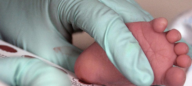 DNA screening test newborn