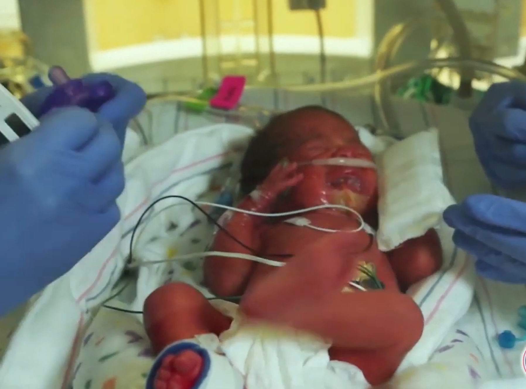 Pro-Lifers Arrested For Protesting CA Hospital Transplanting Aborted Baby Organs Into Lab Rats