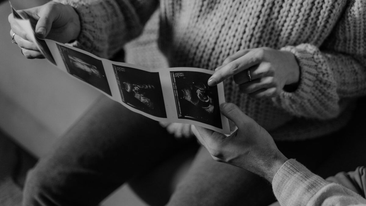 Hands holding ultrasound photos