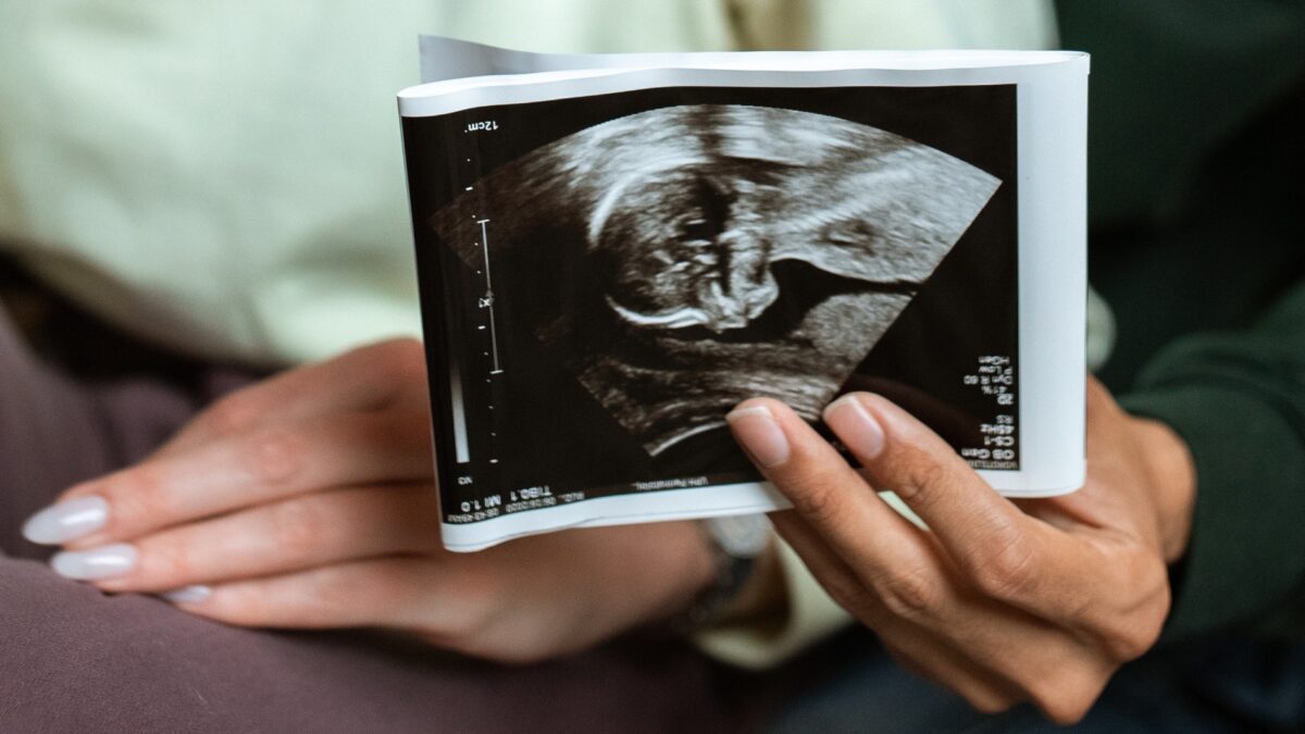 person holding an ultrasound image