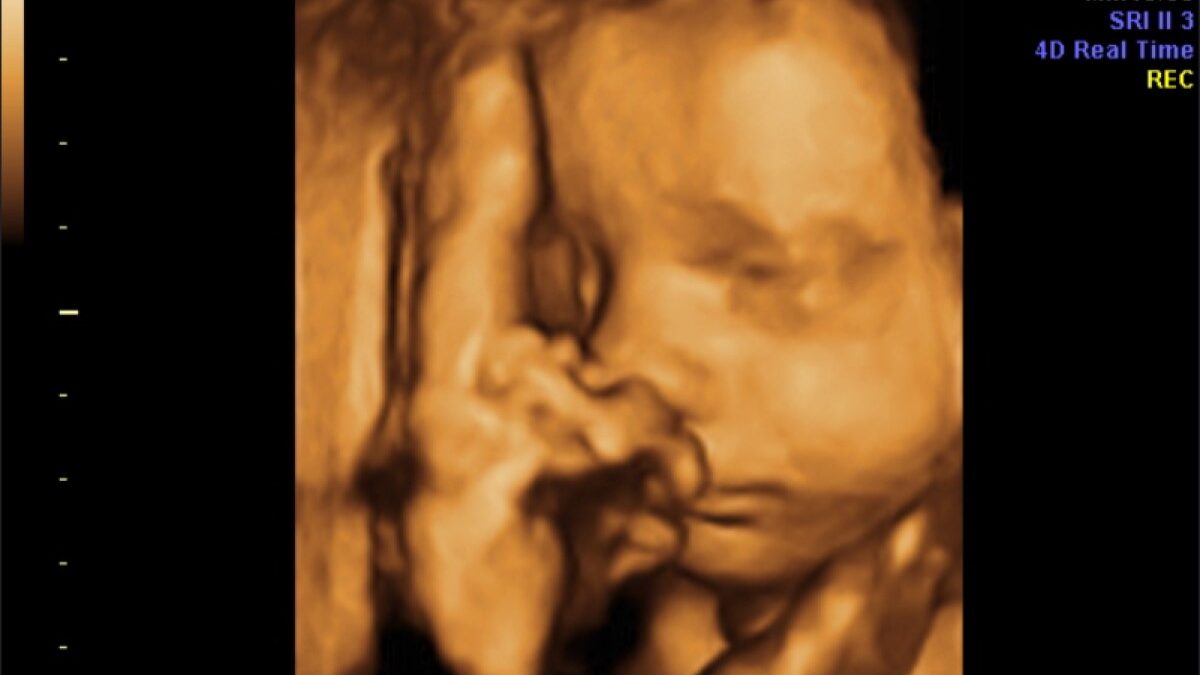 Baby in utero