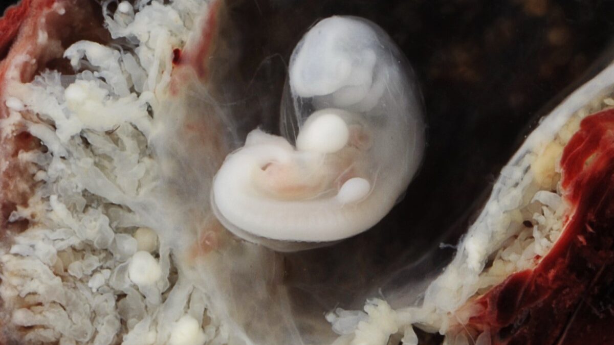 three to four-week old human embryo