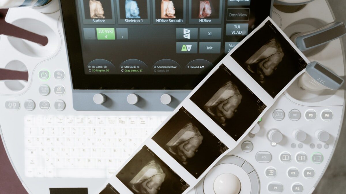 ultrasound on ultrasound machine