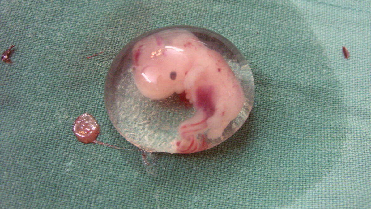 human embryo in petri dish