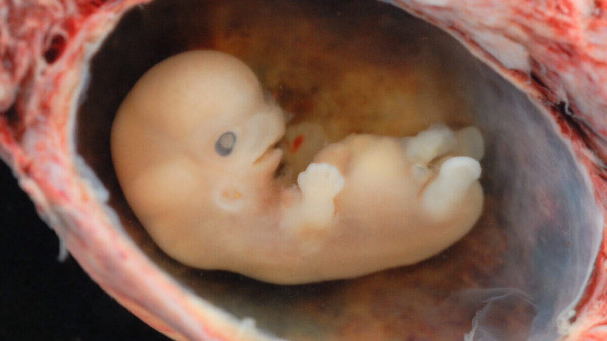 preborn human in development