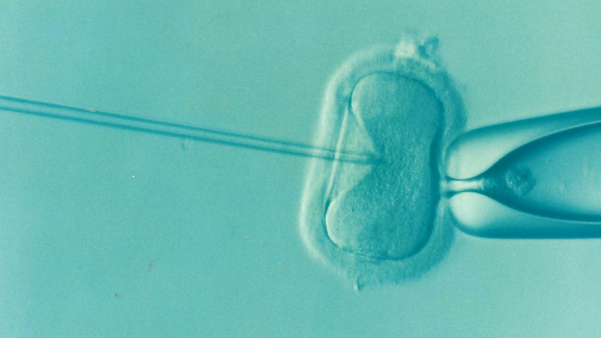 sperm and egg fuse in IVF