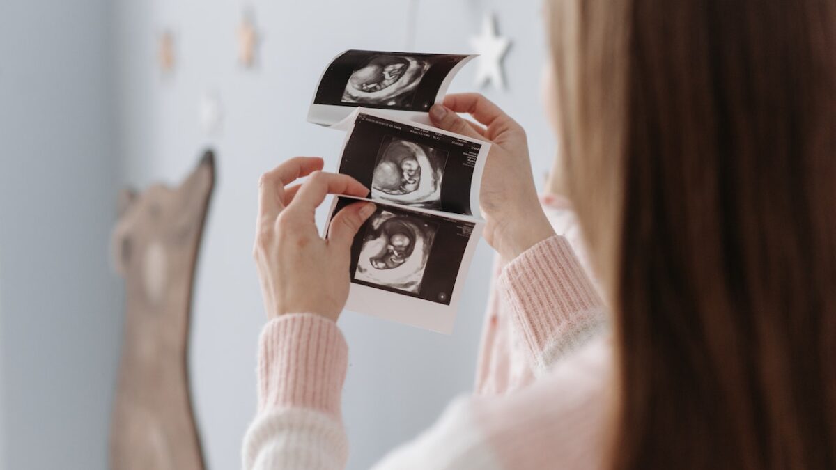 woman holding an ultrasound