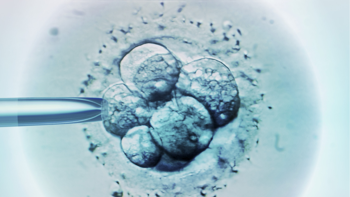 assisted reproductive technology