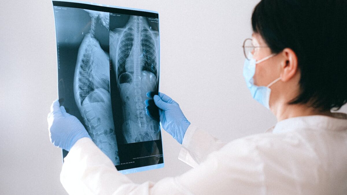 doctor holding an x-ray