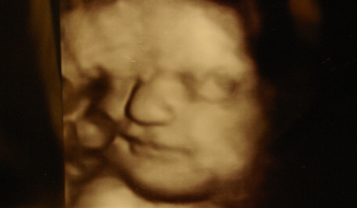 Virginia Proves Democrats Want Abortion Until Birth With No Limits