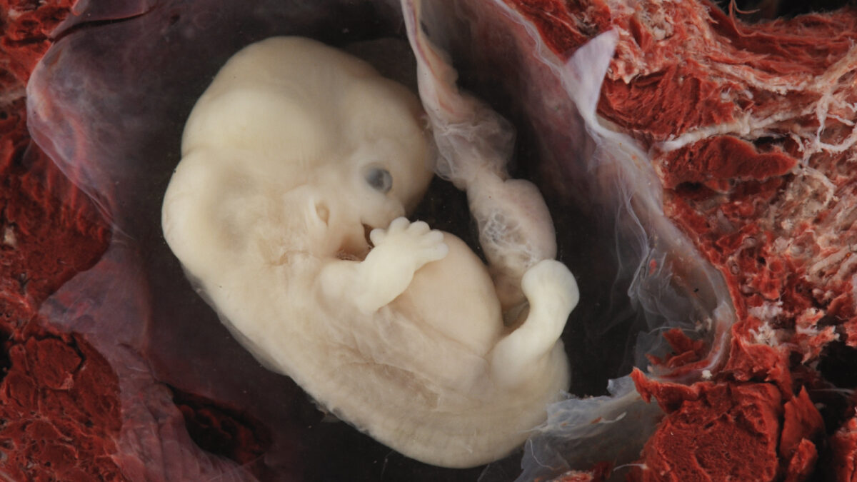 80 Years After Nuremberg Condemned Nazi Research, Doctors Are Still Committing Atrocities