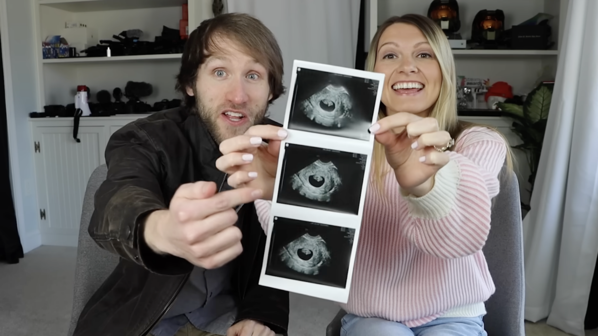 Media Shrug At Aborting Down Syndrome Baby But Cry "Eugenics" At Sydney Sweeney"s Jugs